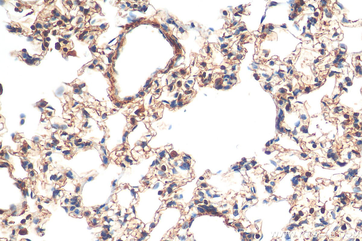 Immunohistochemistry (IHC) staining of rat lung tissue using Endothelin 1 Polyclonal antibody (12191-1-AP)