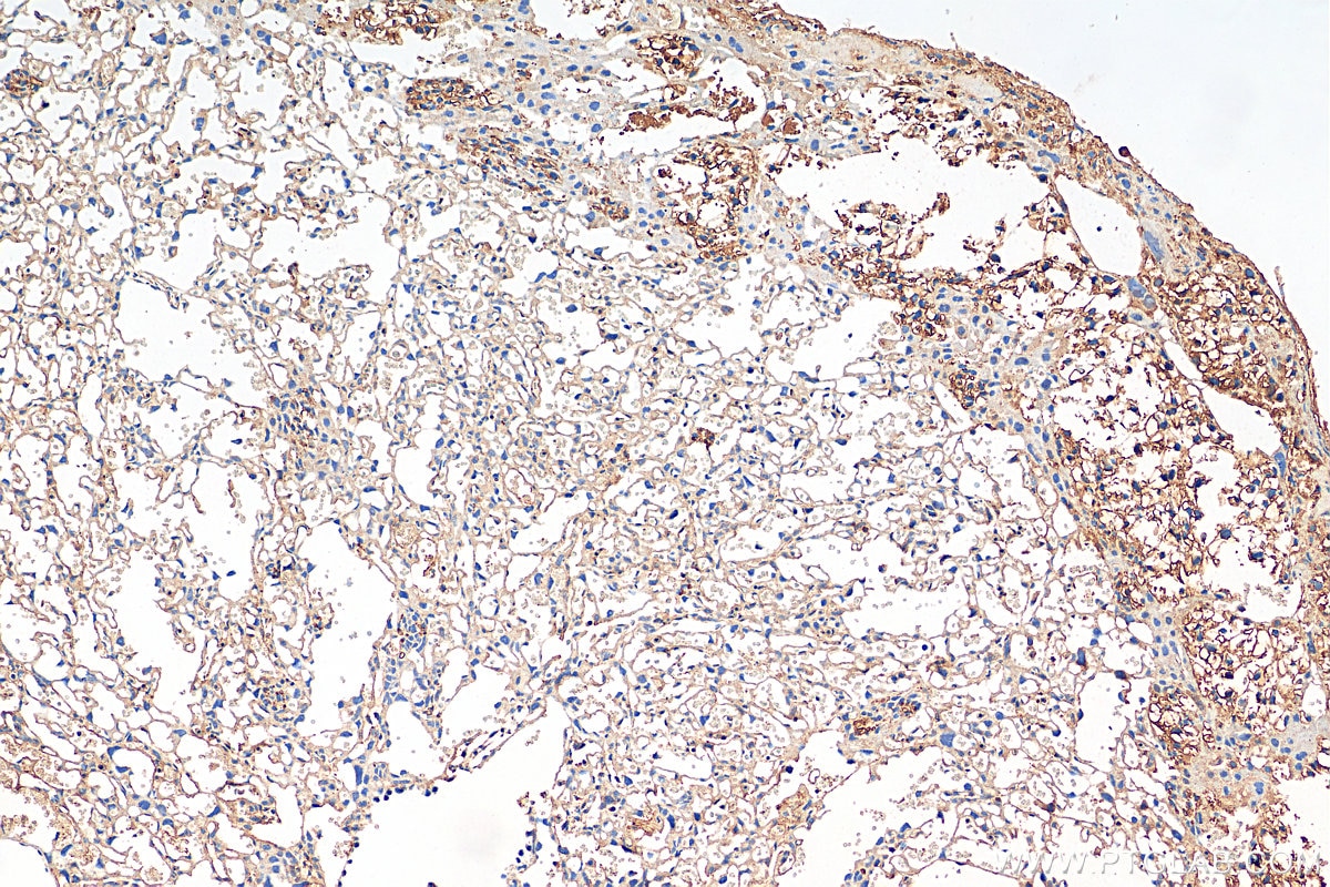Immunohistochemistry (IHC) staining of mouse placenta tissue using Endothelin 1 Polyclonal antibody (12191-1-AP)