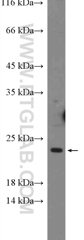 Endothelin 1 Polyclonal antibody