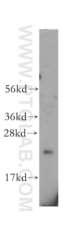 Endothelin 1 Polyclonal antibody