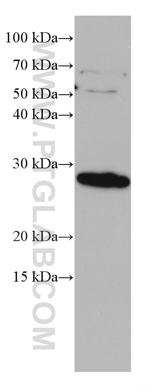 Western Blot (WB) analysis of human placenta tissue using Endothelin 1 Monoclonal antibody (67008-1-Ig)
