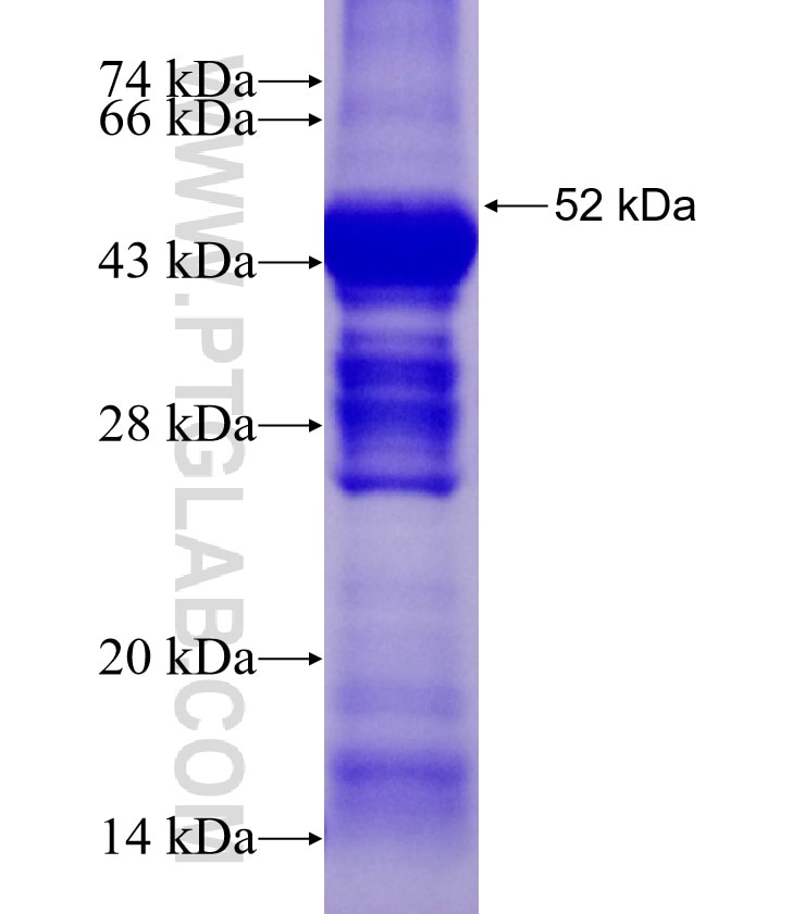 EDN1 fusion protein Ag2847 SDS-PAGE