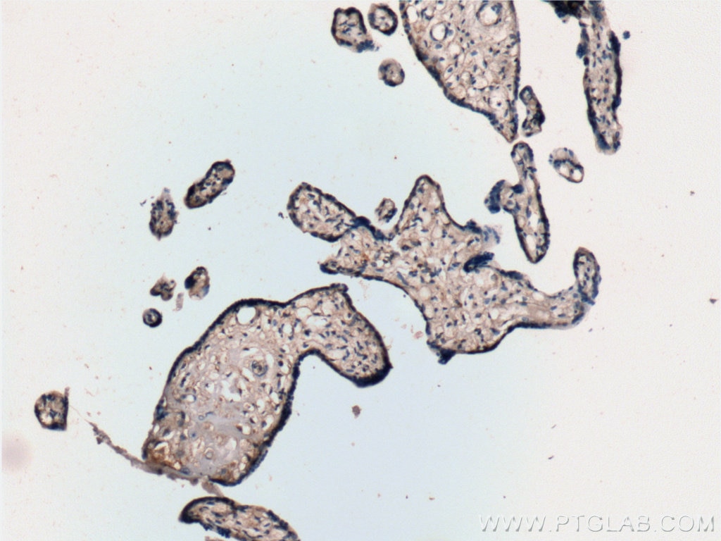 Immunohistochemistry (IHC) staining of human placenta tissue using EDNRB Polyclonal antibody (20964-1-AP)