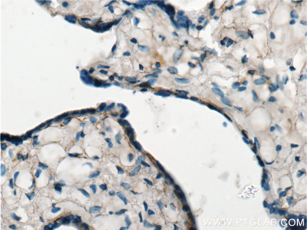 Immunohistochemistry (IHC) staining of human placenta tissue using EDNRB Polyclonal antibody (20964-1-AP)