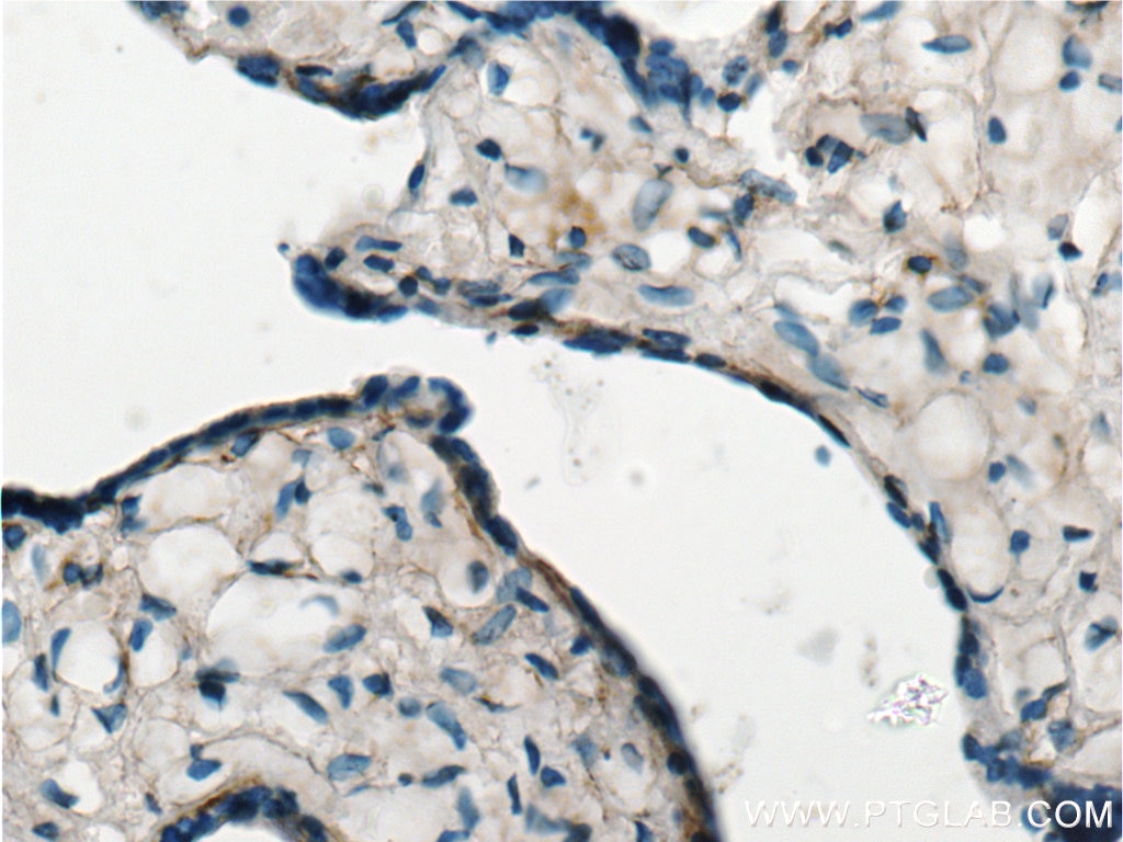 IHC staining of human placenta using 20964-1-AP