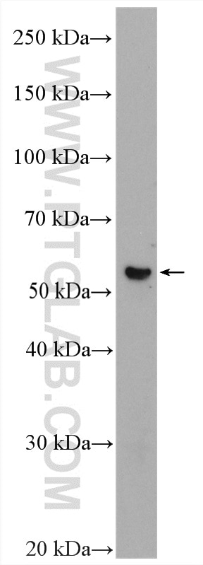 Western Blot (WB) analysis of human placenta tissue using EDNRB Polyclonal antibody (20964-1-AP)