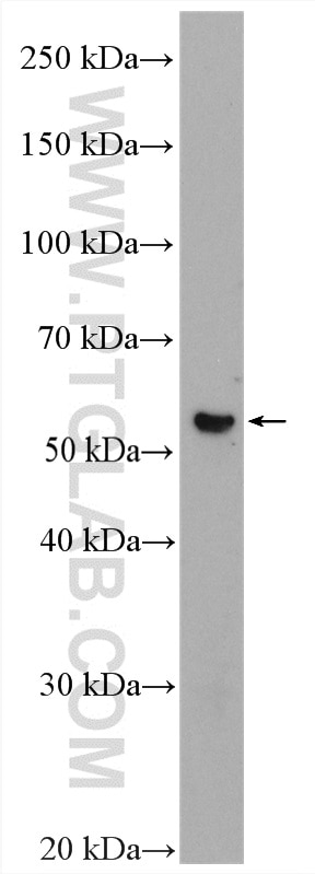 WB analysis of human placenta using 20964-1-AP