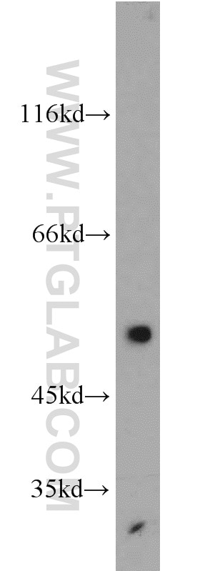 Western Blot (WB) analysis of mouse placenta tissue using EDNRB Polyclonal antibody (20964-1-AP)