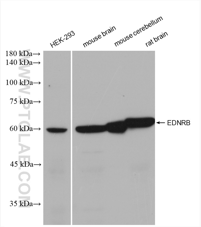 Western Blot (WB) analysis of various lysates using EDNRB Recombinant antibody (82818-2-RR)