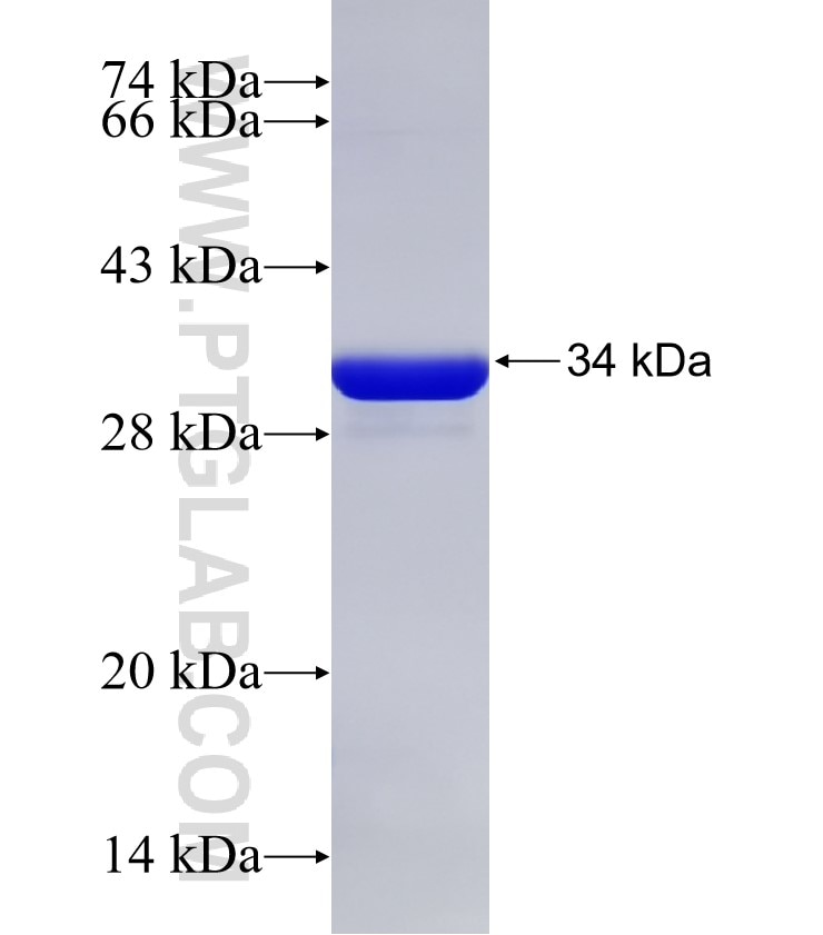 EDNRB fusion protein Ag19956 SDS-PAGE