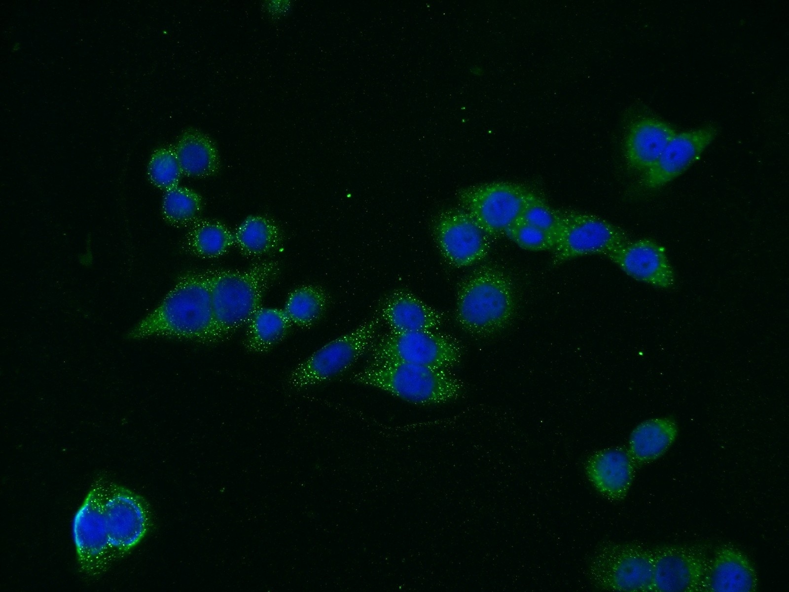 EEA1 Polyclonal antibody