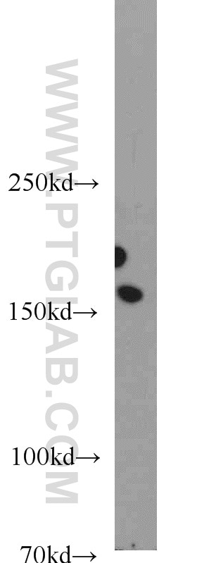 Western Blot (WB) analysis of NIH/3T3 cells using EEA1 Polyclonal antibody (22266-1-AP)