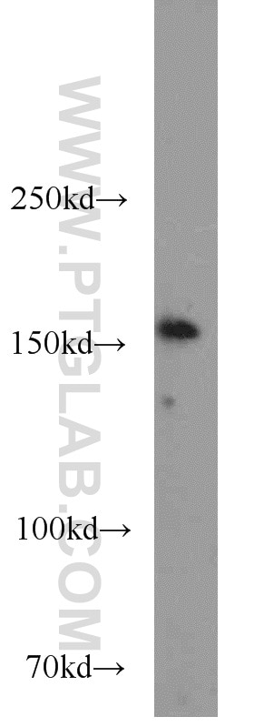 EEA1 Polyclonal antibody