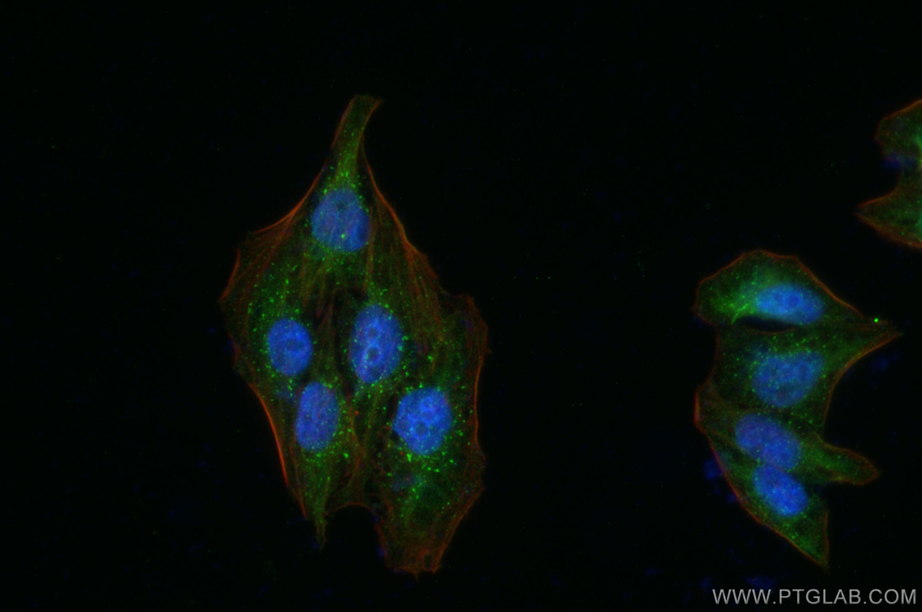 IF Staining of HepG2 using 28347-1-AP