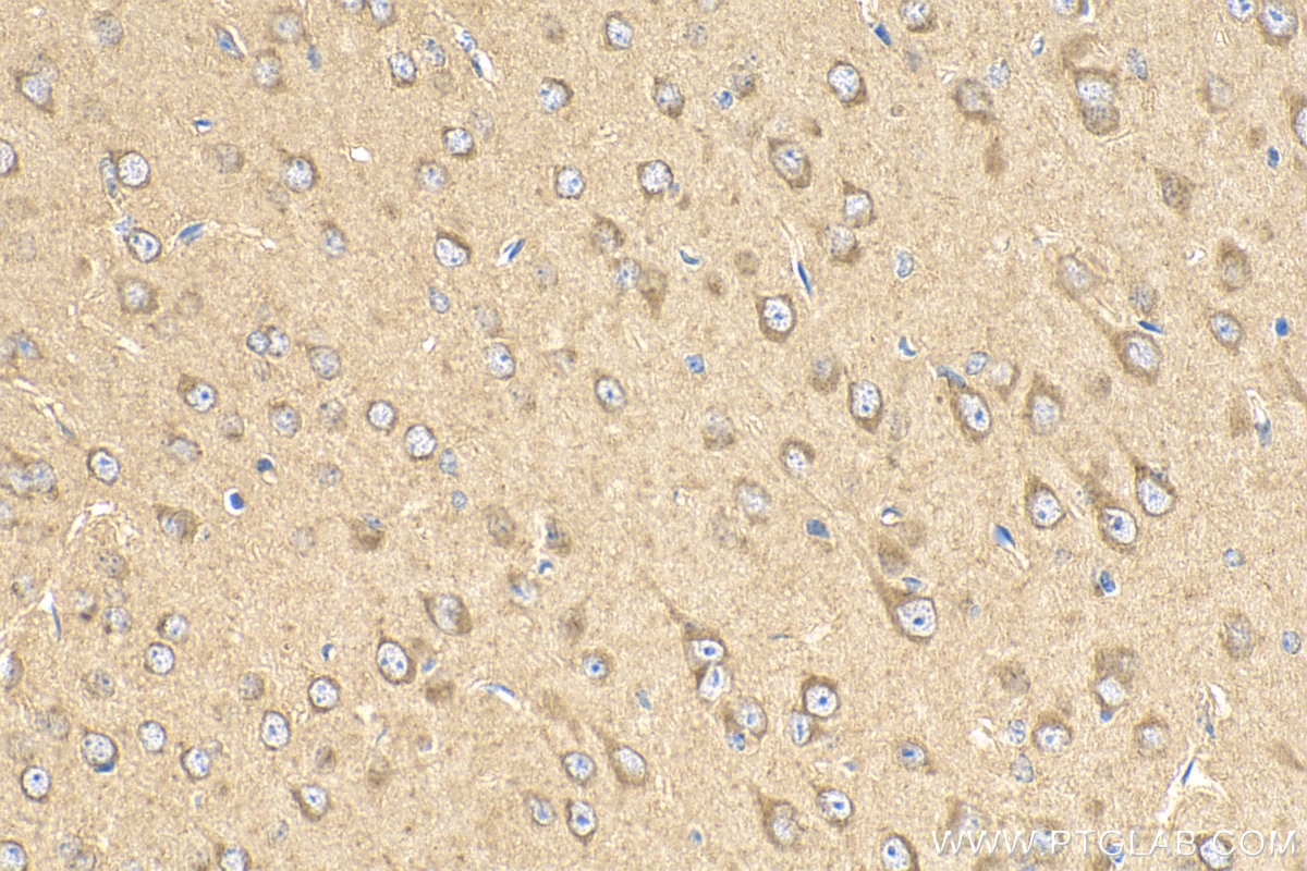 IHC staining of mouse brain using 28347-1-AP