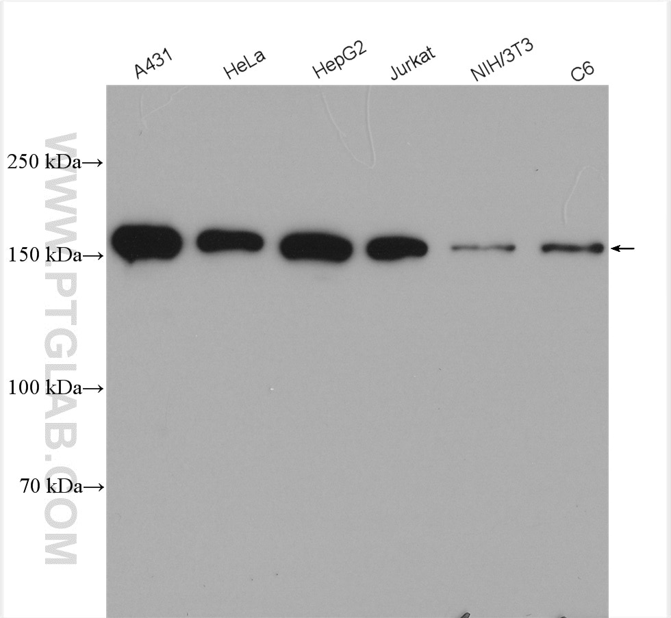 Western Blot (WB) analysis of various lysates using EEA1 Polyclonal antibody (28347-1-AP)