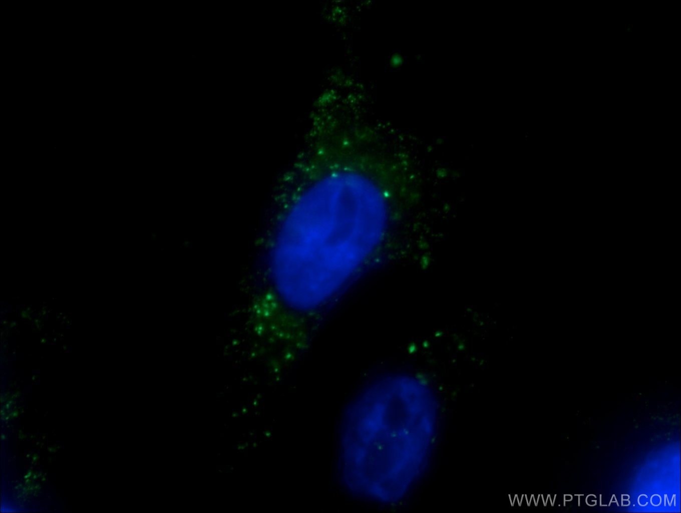 Immunofluorescence (IF) / fluorescent staining of HeLa cells using EEA1 Monoclonal antibody (66218-1-Ig)