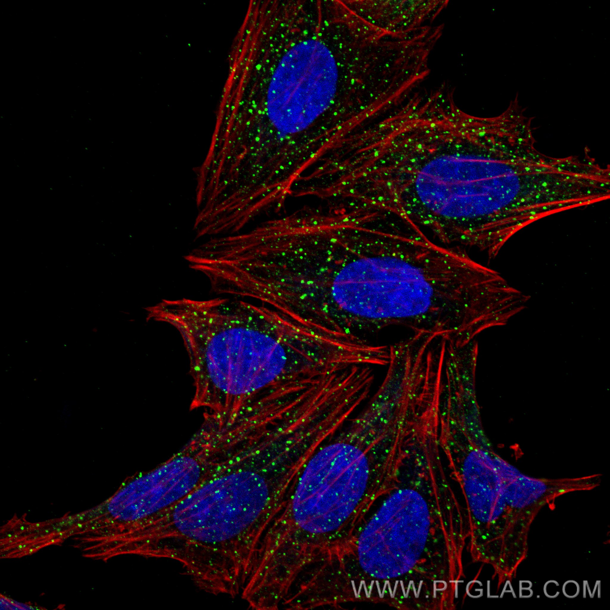 Immunofluorescence (IF) / fluorescent staining of HepG2 cells using EEA1 Monoclonal antibody (68065-1-Ig)