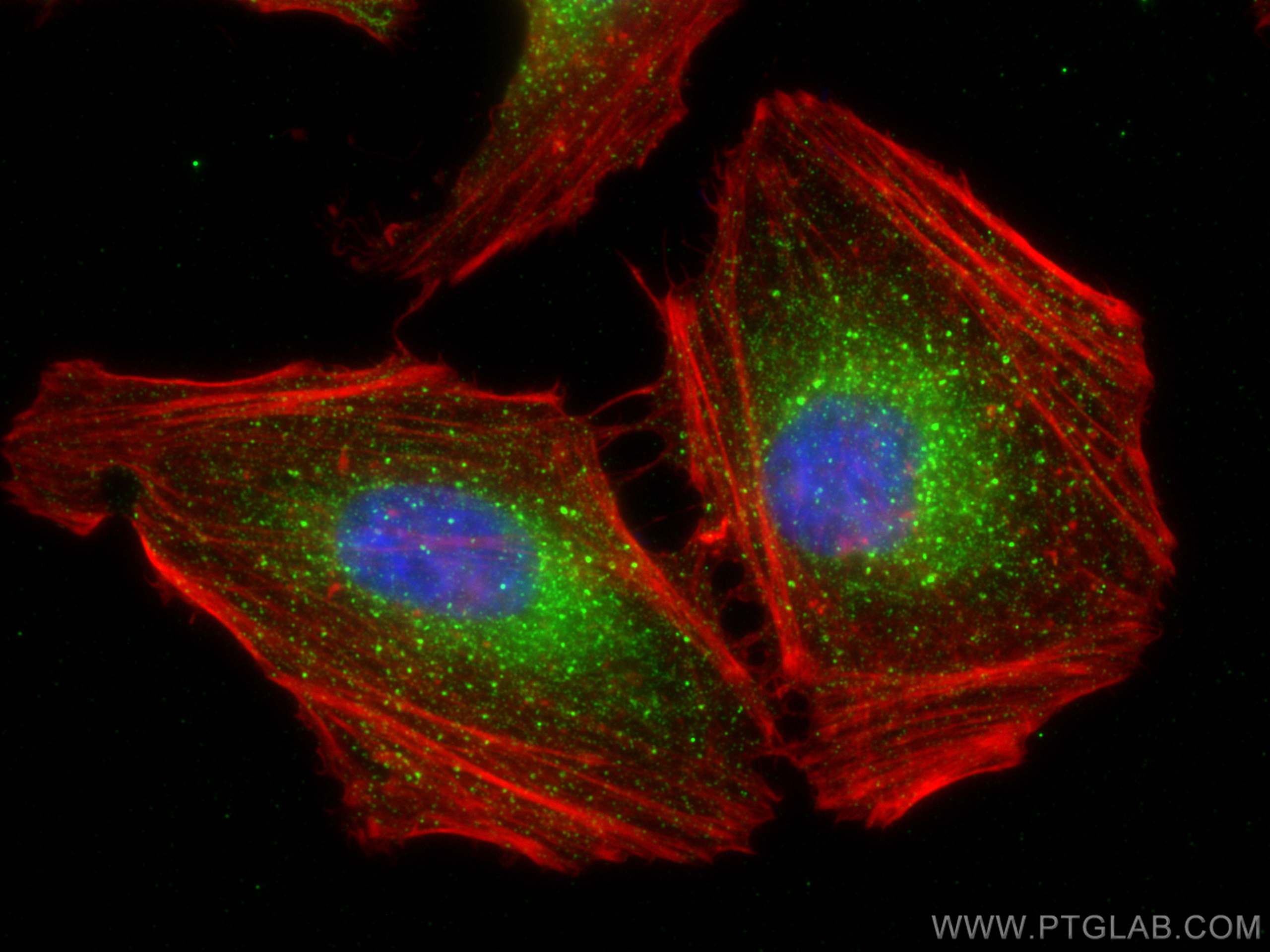 Immunofluorescence (IF) / fluorescent staining of HeLa cells using EEA1 Monoclonal antibody (68065-1-Ig)