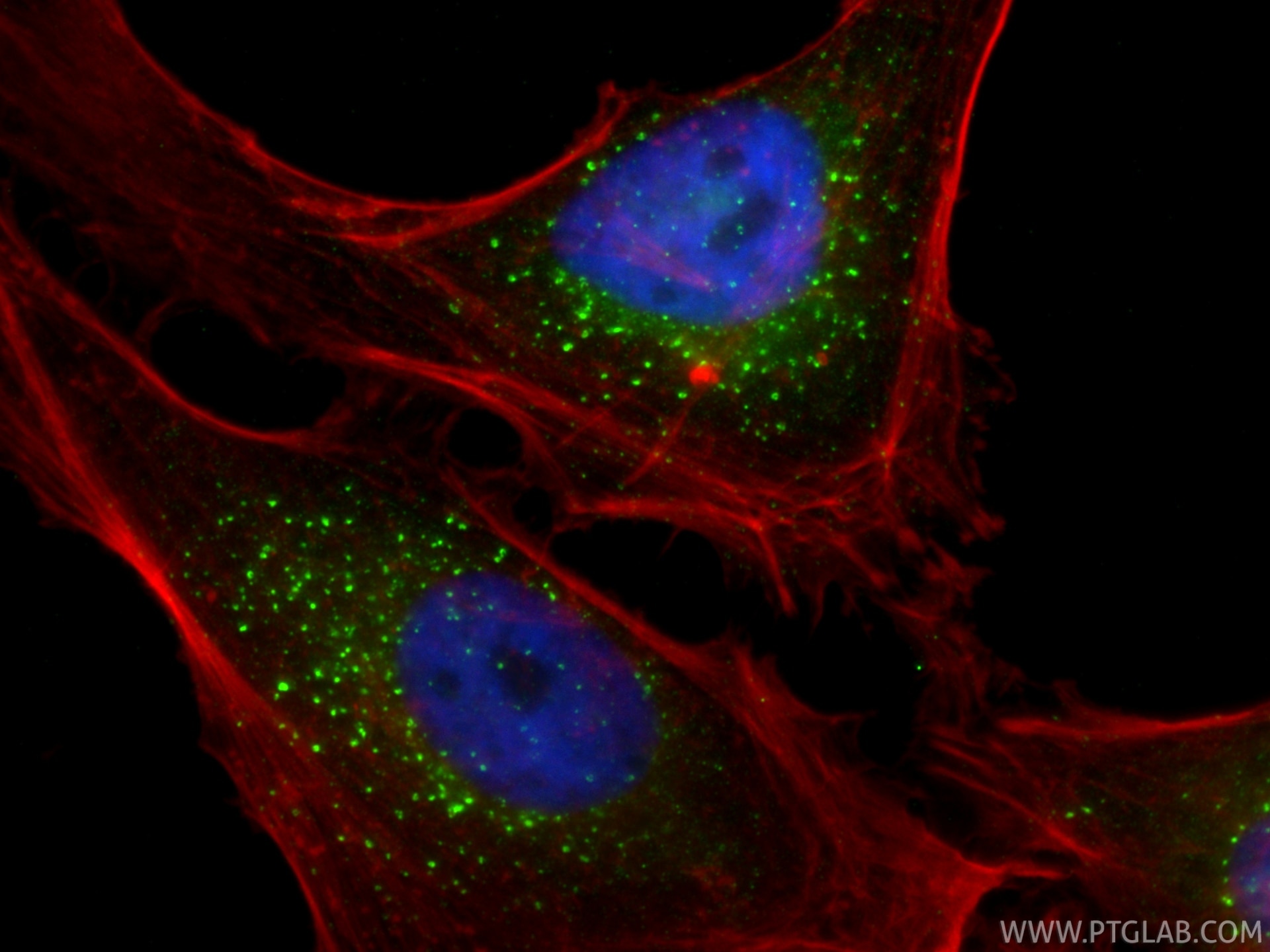 Immunofluorescence (IF) / fluorescent staining of HeLa cells using EEA1 Monoclonal antibody (68065-1-Ig)