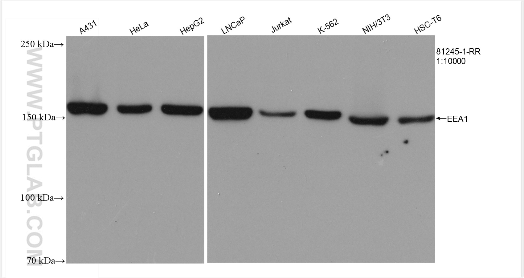 Western Blot (WB) analysis of various lysates using EEA1 Recombinant antibody (81245-1-RR)