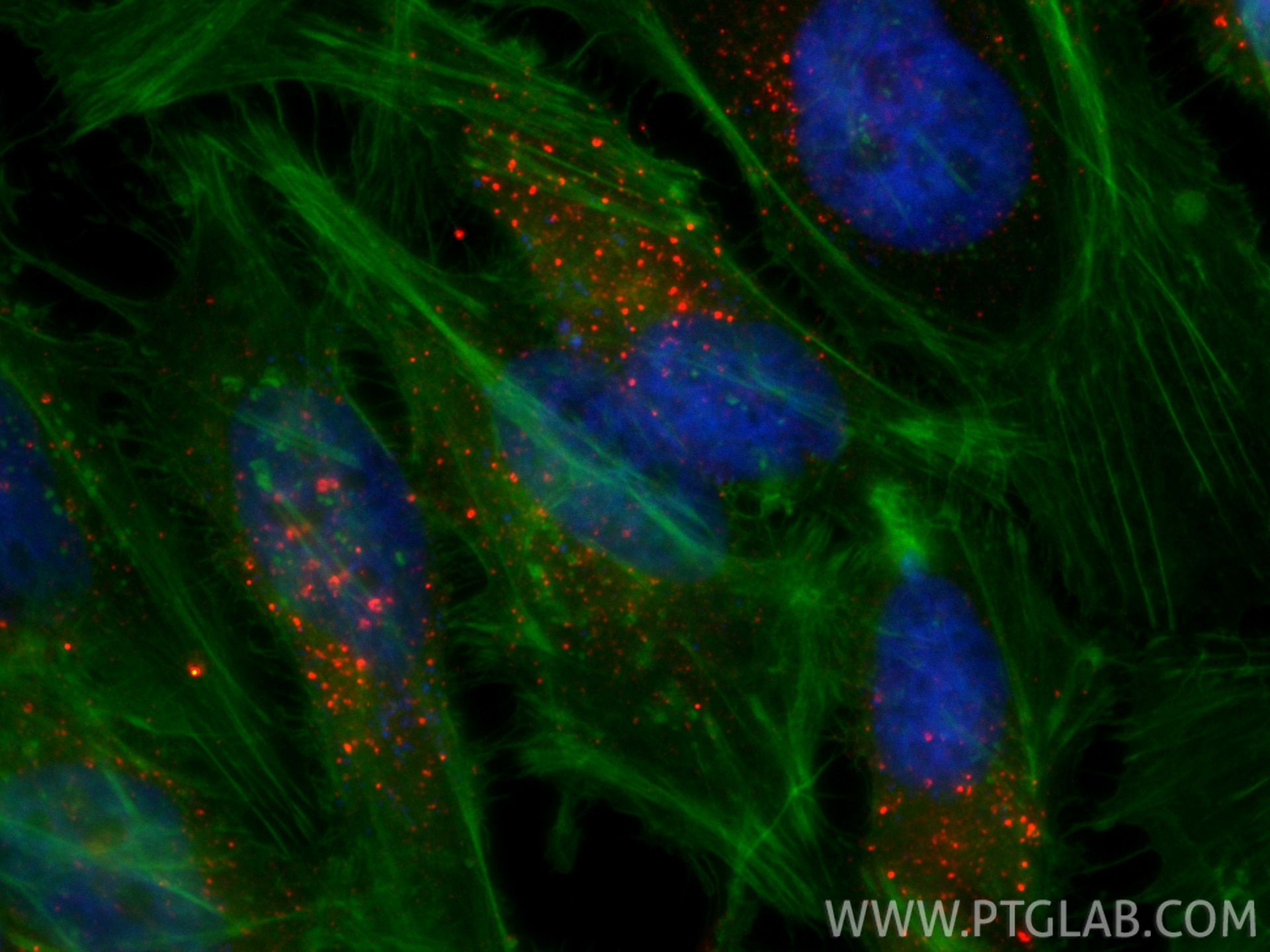 Immunofluorescence (IF) / fluorescent staining of HeLa cells using CoraLite®594-conjugated EEA1 Monoclonal antibody (CL594-68065)