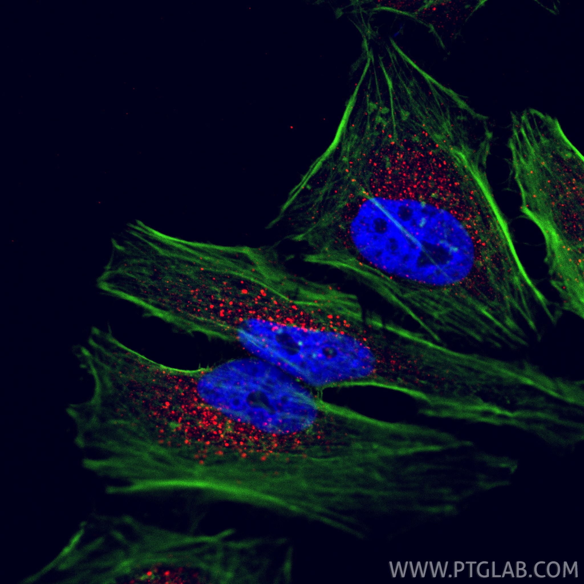 Immunofluorescence (IF) / fluorescent staining of HeLa cells using CoraLite®594-conjugated EEA1 Monoclonal antibody (CL594-68065)