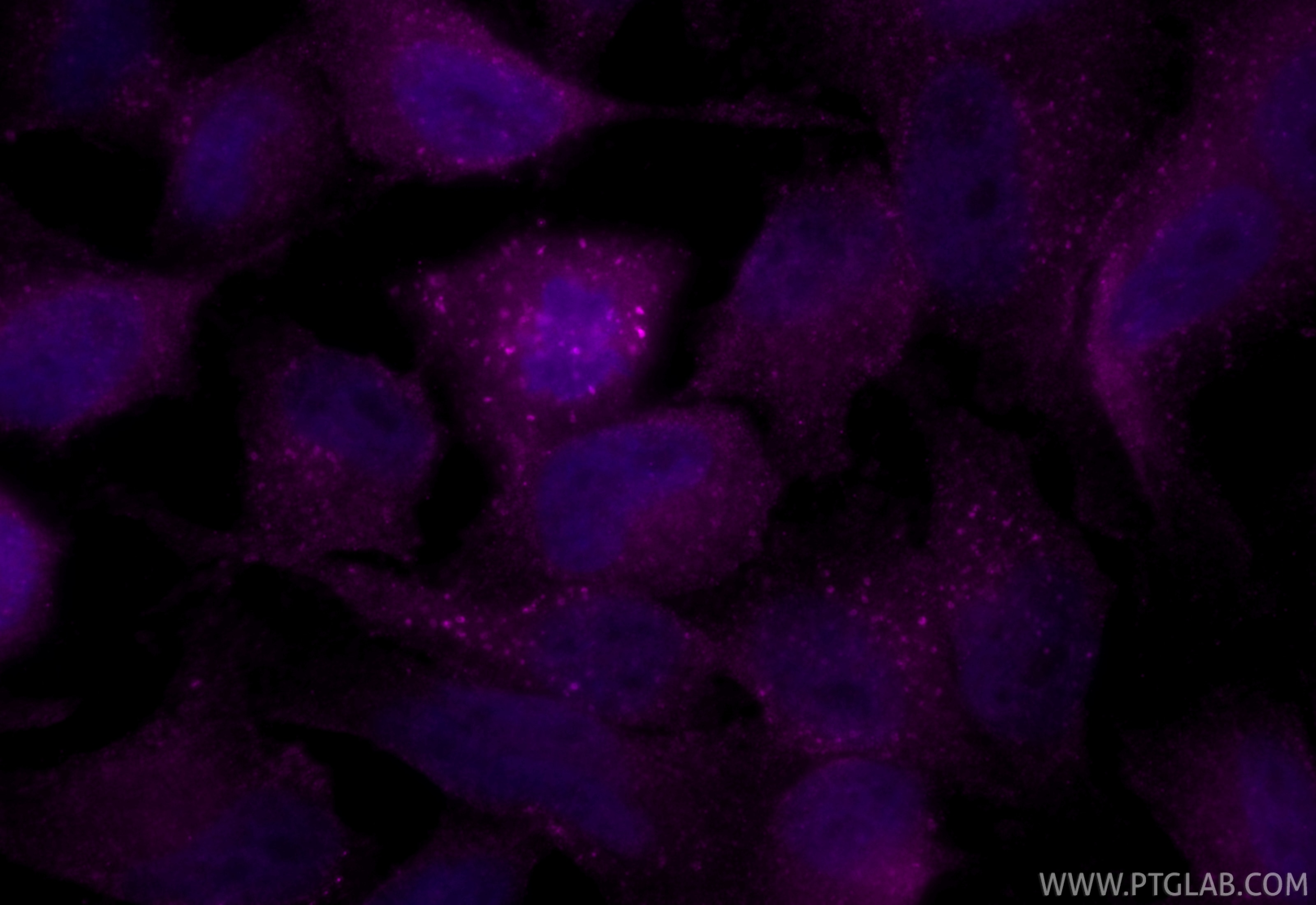 Immunofluorescent analysis of (4% PFA) fixed HeLa cells using CoraLite® Plus 647 EEA1 antibody (CL647-28347) at dilution of 1:200. Immunofluorescence (IF) / fluorescent staining of HeLa cells using CoraLite® Plus 647-conjugated EEA1 Polyclonal anti (CL647-28347)