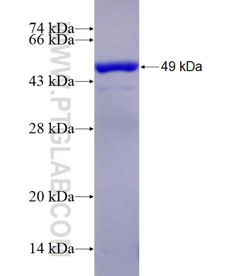 EEA1 fusion protein Ag28814 SDS-PAGE