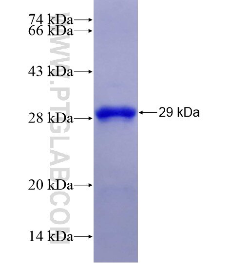 EEA1 fusion protein Ag28849 SDS-PAGE