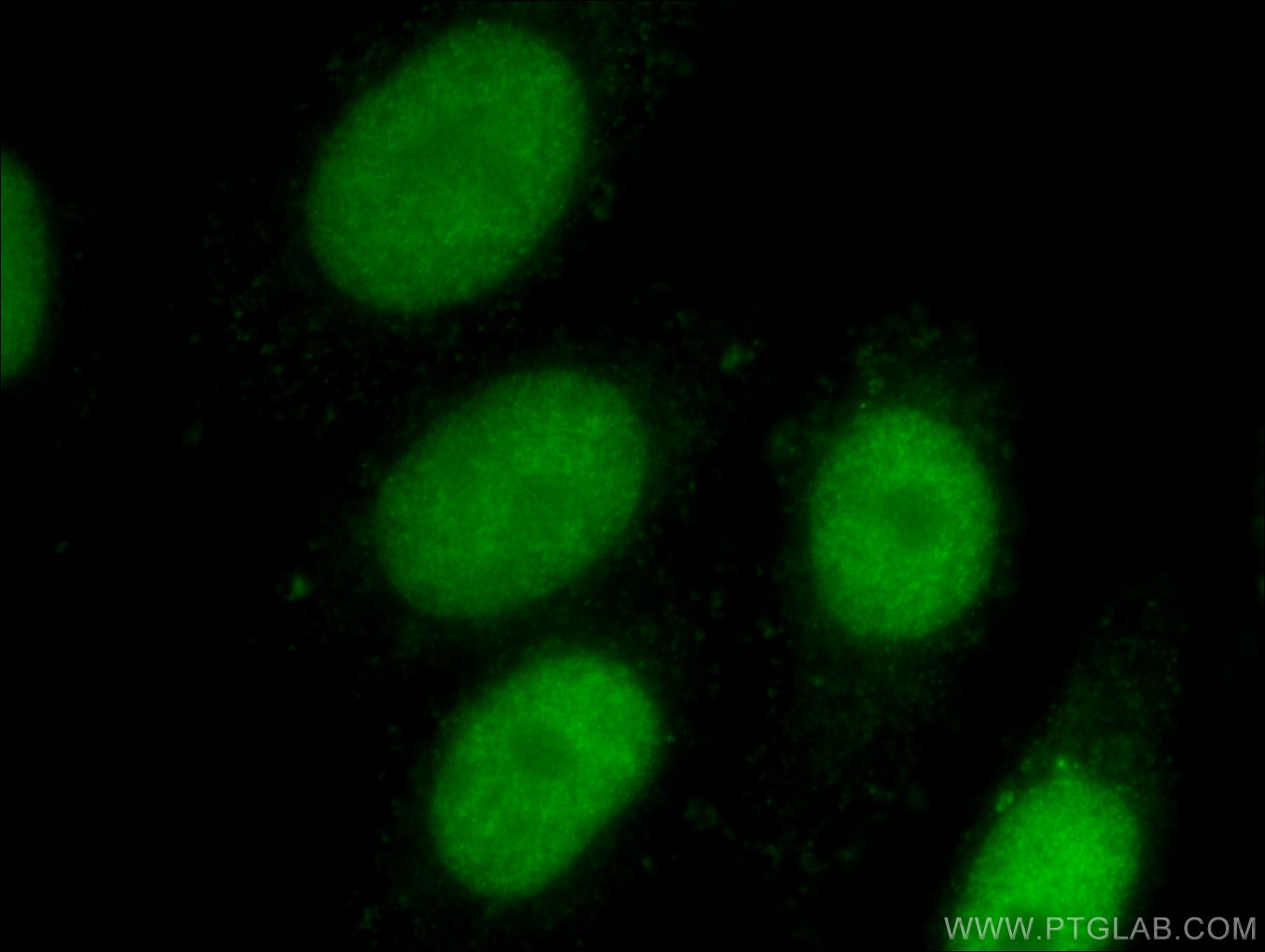 Immunofluorescence (IF) / fluorescent staining of HepG2 cells using EED Polyclonal antibody (16818-1-AP)