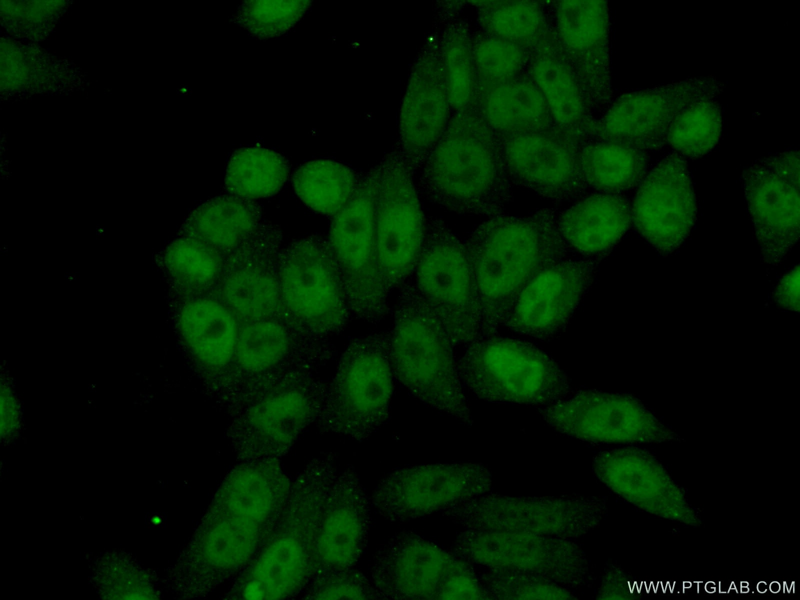 Immunofluorescence (IF) / fluorescent staining of HeLa cells using EED Polyclonal antibody (16818-1-AP)