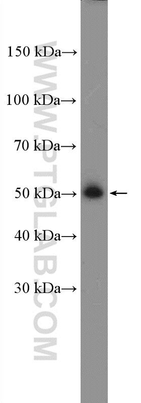 Western Blot (WB) analysis of HepG2 cells using EED Polyclonal antibody (16818-1-AP)