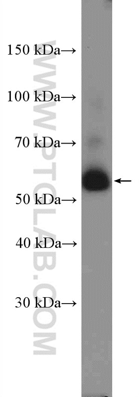 Western Blot (WB) analysis of COLO 320 cells using EED Polyclonal antibody (16818-1-AP)