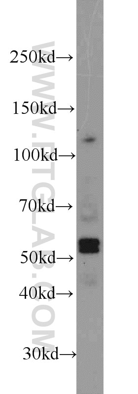 Western Blot (WB) analysis of K-562 cells using EED Polyclonal antibody (16818-1-AP)