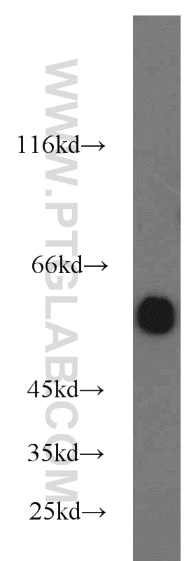 Western Blot (WB) analysis of COLO 320 cells using EED Polyclonal antibody (16818-1-AP)