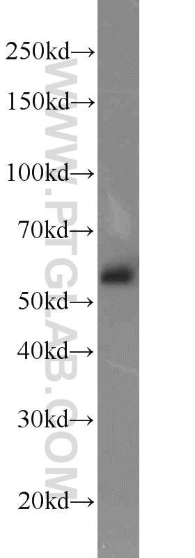 Western Blot (WB) analysis of PC-3 cells using EED Polyclonal antibody (16818-1-AP)