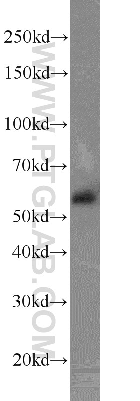 WB analysis of PC-3 using 16818-1-AP