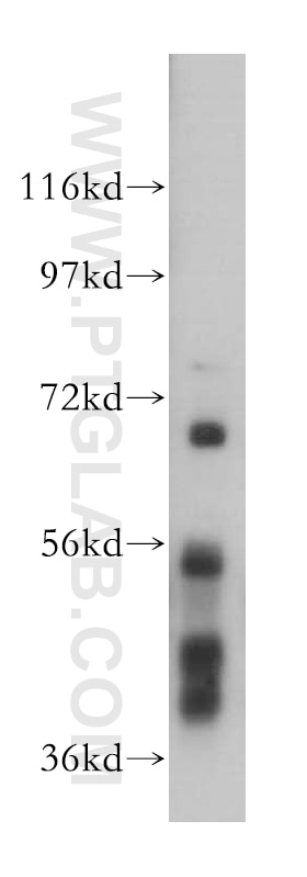 Western Blot (WB) analysis of HeLa cells using EED Polyclonal antibody (16818-1-AP)