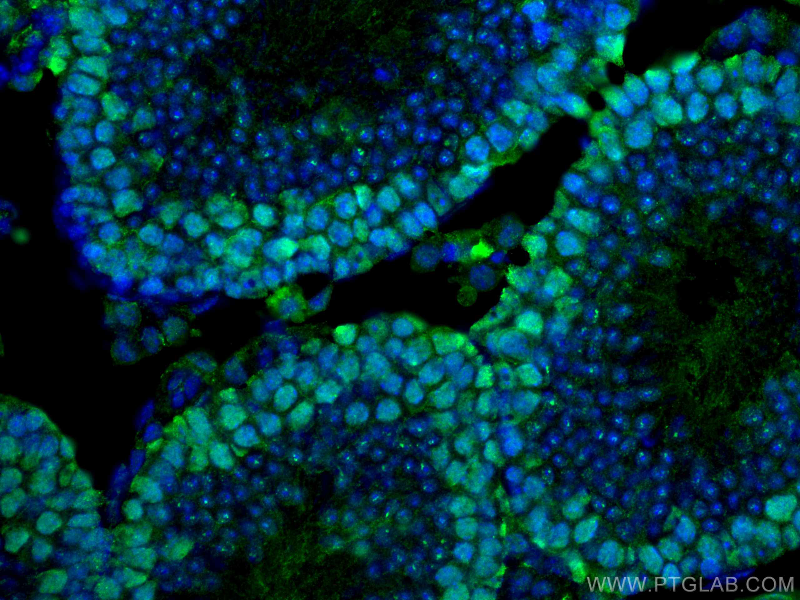 Immunofluorescence (IF) / fluorescent staining of mouse testis tissue using EED Monoclonal antibody (67756-1-Ig)