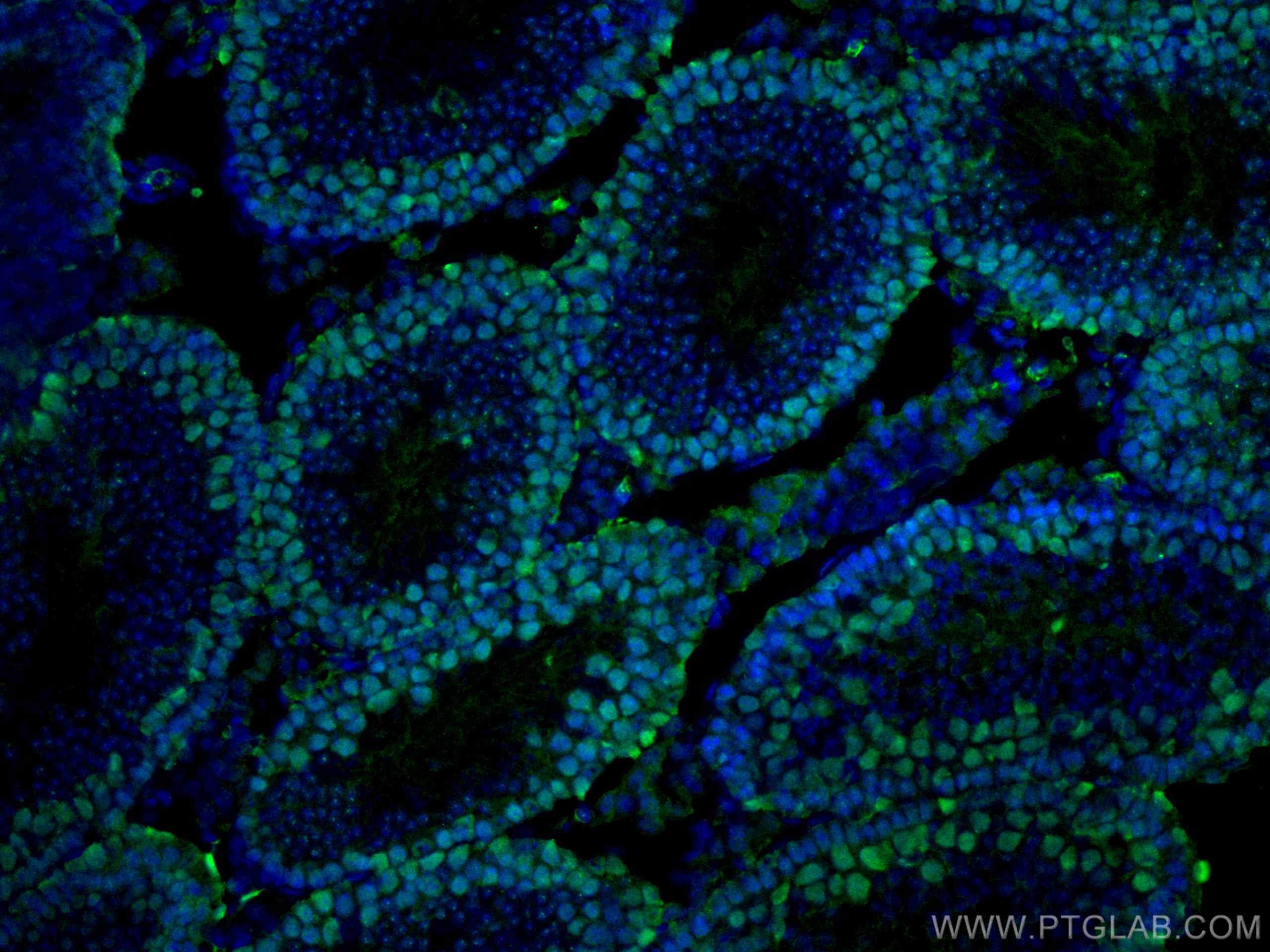Immunofluorescence (IF) / fluorescent staining of mouse testis tissue using EED Monoclonal antibody (67756-1-Ig)
