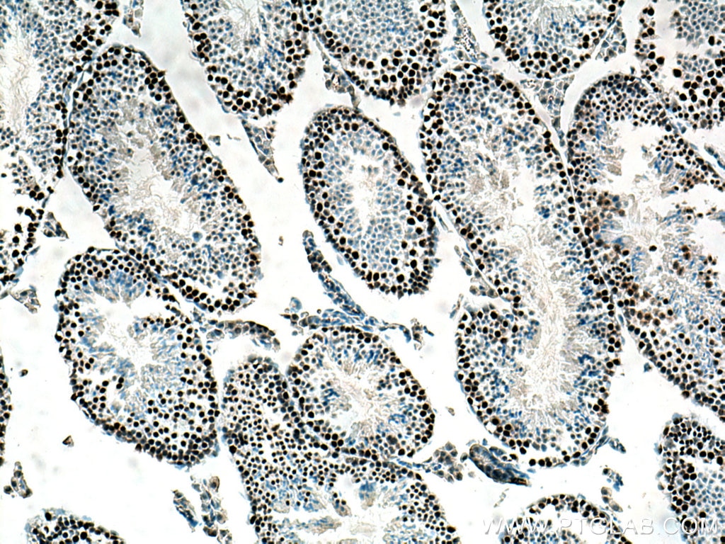 Immunohistochemistry (IHC) staining of mouse testis tissue using EED Monoclonal antibody (67756-1-Ig)