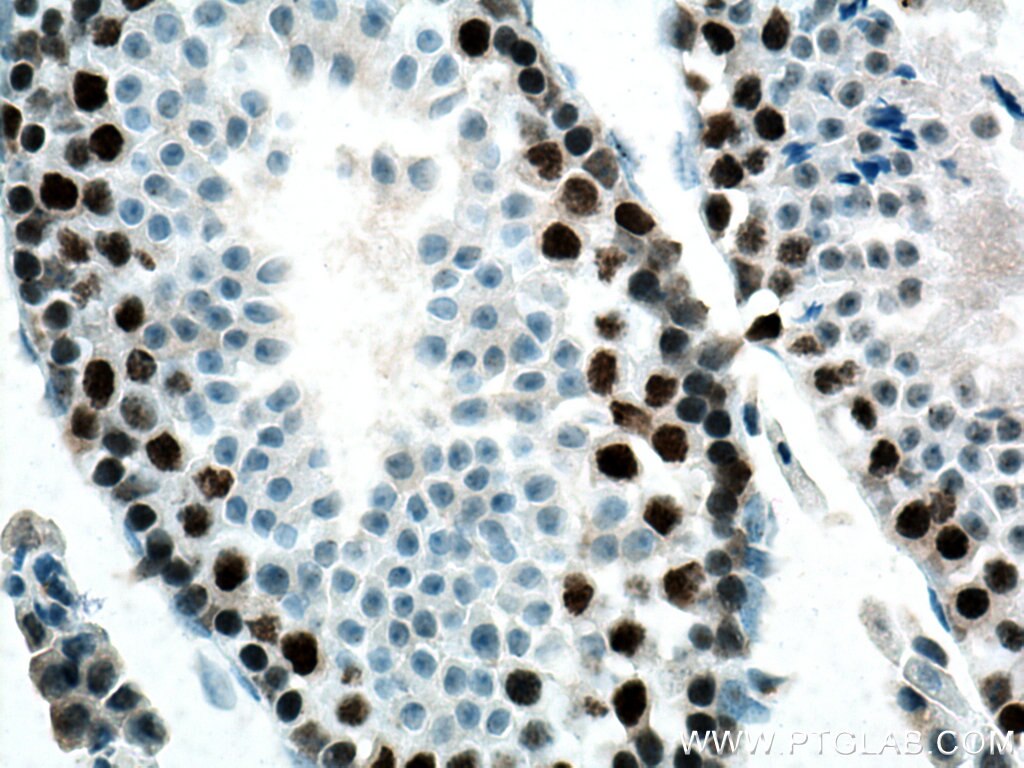 Immunohistochemistry (IHC) staining of mouse testis tissue using EED Monoclonal antibody (67756-1-Ig)