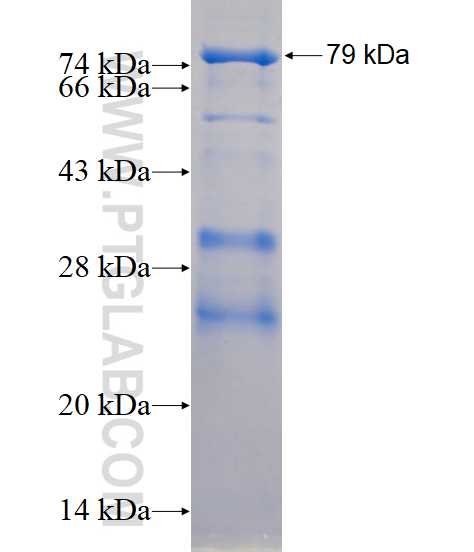 EED fusion protein Ag10358 SDS-PAGE