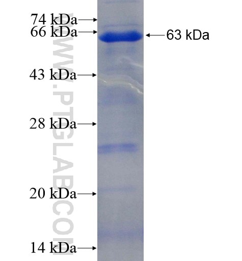 EED fusion protein Ag10369 SDS-PAGE