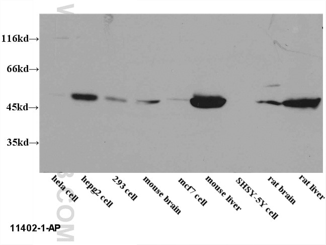 EEF1A1 Polyclonal antibody