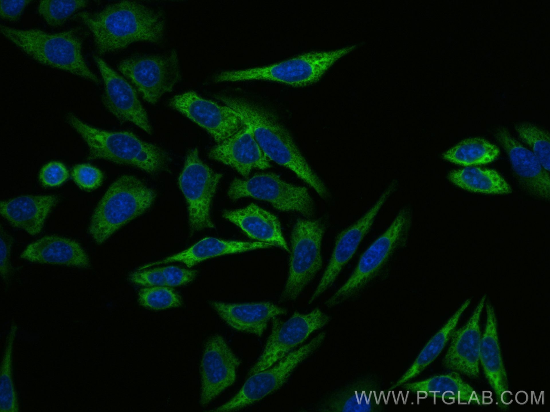 Immunofluorescence (IF) / fluorescent staining of HepG2 cells using EEF1A1 Polyclonal antibody (11402-1-AP)