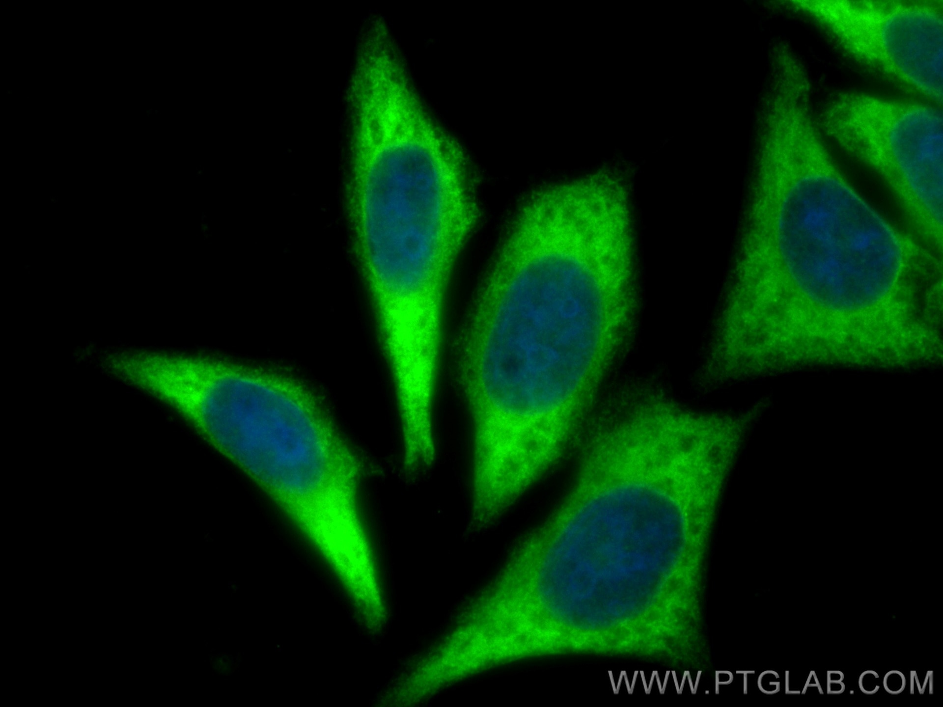 Immunofluorescence (IF) / fluorescent staining of HepG2 cells using EEF1A1 Polyclonal antibody (11402-1-AP)