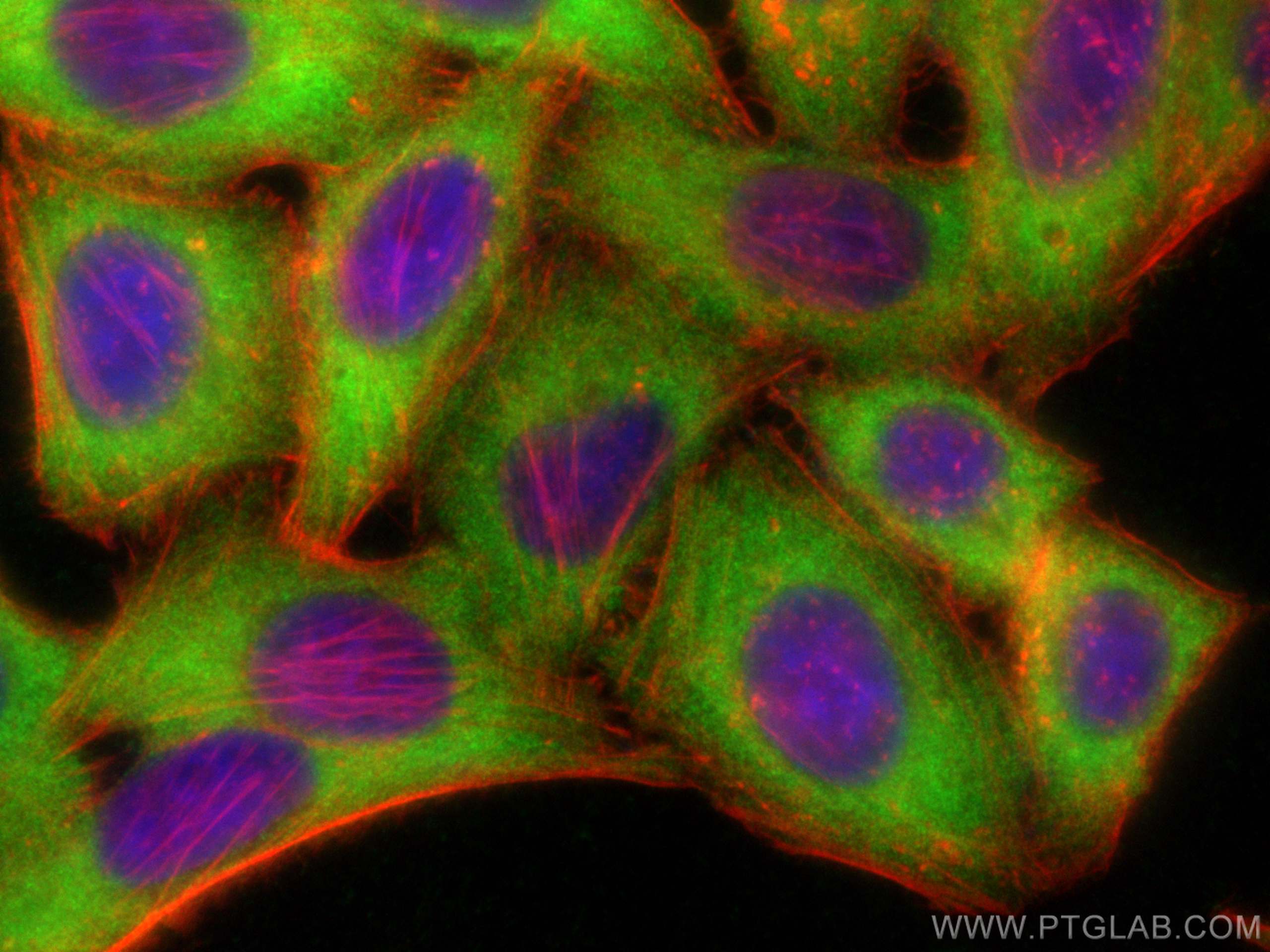 IF Staining of HepG2 using 11402-1-AP