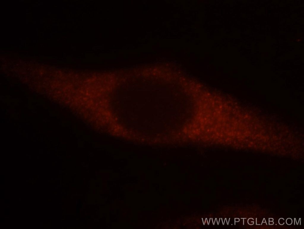 Immunofluorescence (IF) / fluorescent staining of HeLa cells using EEF1A1 Polyclonal antibody (11402-1-AP)